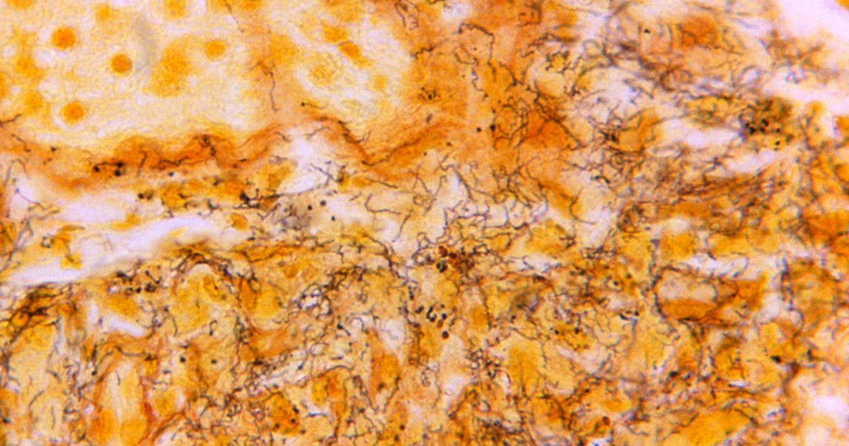 1983 AIDS Evaluation Unit and HIV Epidemic Response